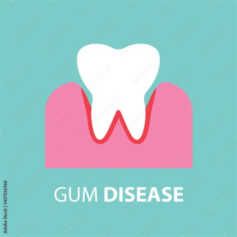 gum disease concept- vector illustration Stock Vector | Adobe Stock