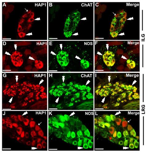 Brain Sciences Free Full Text Immunohistochemical Distribution And