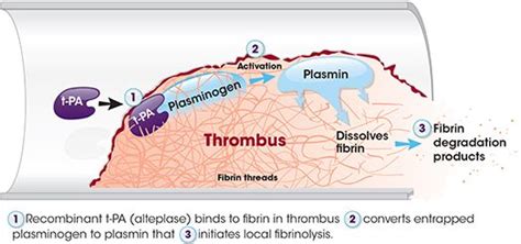 Alteplase Mechanism of Action