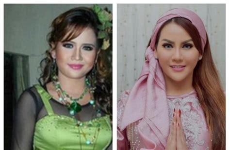 Foto Artis Sebelum Dan Sesudah Oplas Ada Yang Beda Banget Sampai