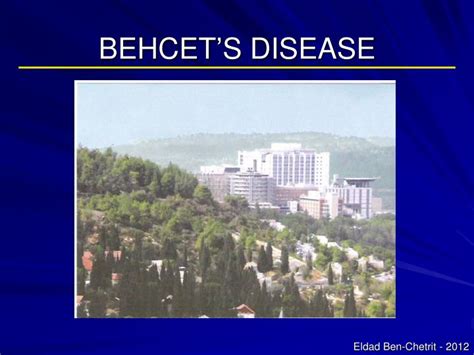 PPT - BEHCET’S DISEASE PowerPoint Presentation, free download - ID:6448387