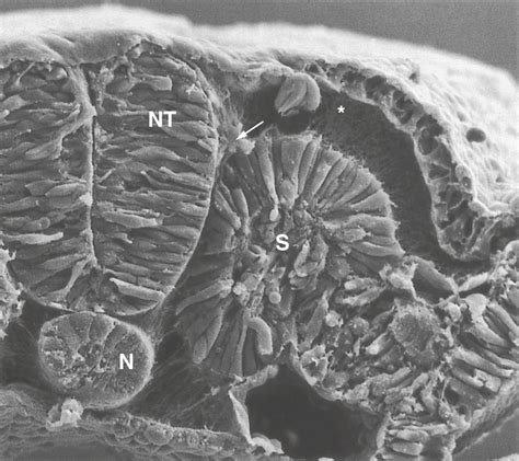 Neural Crest Clinical Tree