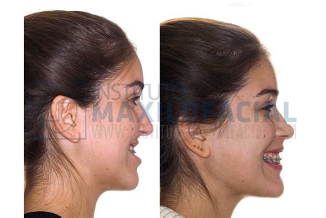 Laura Instituto Maxilofacial