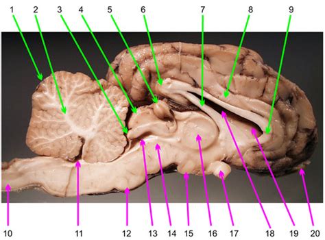 Neuro Exam 3 Sheep Brain Labeling Flashcards Quizlet