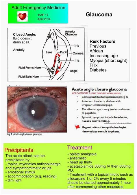 Adult Emergency Medicine Glaucoma