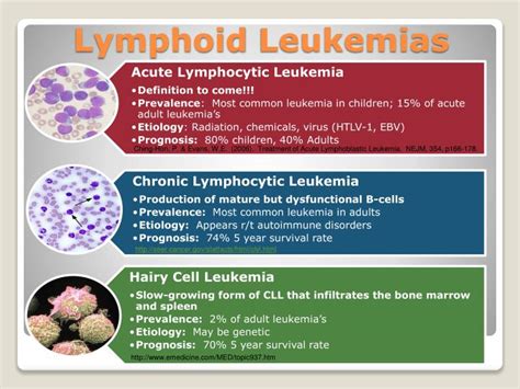 Ppt Acute Lymphocytic Leukemia Powerpoint Presentation Id 65562