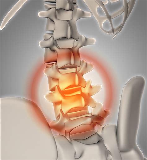 Lumbar Sympathetic Nerve Block Genesis
