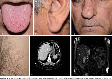 Figure 1 From The Importance Of A Multidisciplinary Approach In A