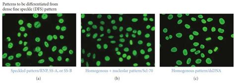 Manejo Pr Ctico De Pruebas Inmunol Gicas En Autoinmunidad Pdf Free