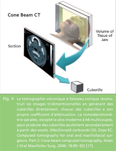 Pdf Place De La Tomographie Volumique Faisceau Conique En Imagerie