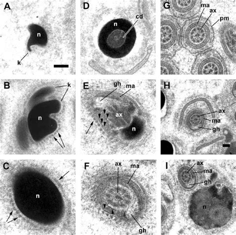 Spermatozoid Ultrastructure Of Microhedyle Remanei Cross Sections