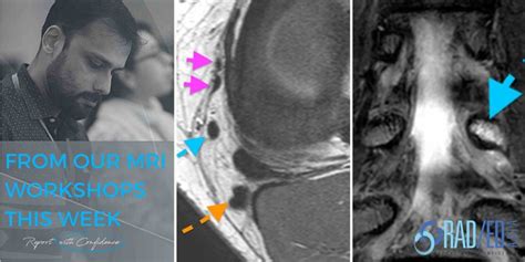 MSK MRI COURSES: KEY POINTS FROM OUR MSK MRI COURSES - Radedasia