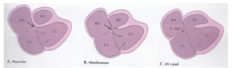 Line Drawings Demonstrating Two Dimensional Echocardiographic