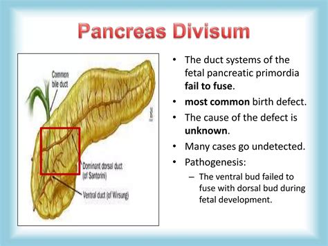 Pancreas Congenital Anomalies Agenesis Pancreas Divisum Annular