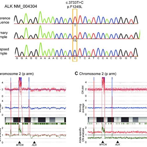 Results of SNP array analysis in (A) primary sample and (B) relapsed ...