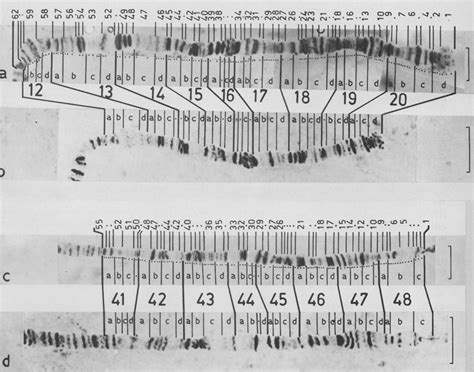 Cytologyofthesegmentsofxuand Band2nd Chromosomecand Download