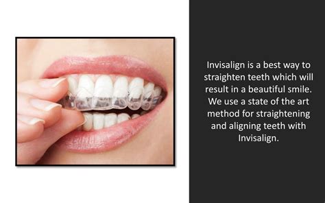 Ppt Invisalign An Invisible Way To Straighten Your Teeth In Chicago