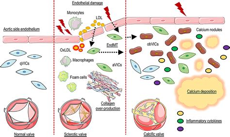 Frontiers The Complex Interplay Of Inflammation Metabolism