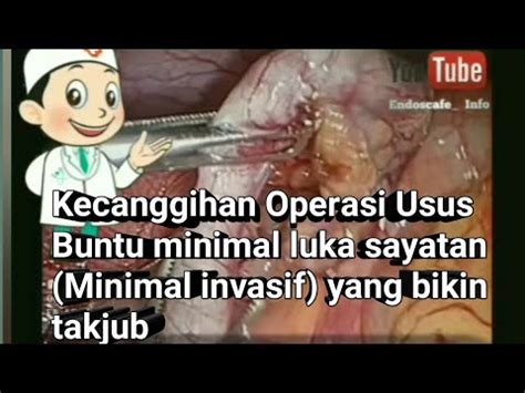 Laparoskopi Usus Buntu Operasi Usus Buntu Luka Operasi Sangat Kecil