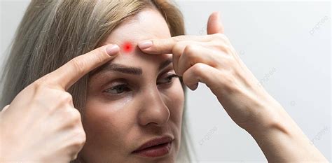 Asian Woman With Skin Allergy Worried Expression Woman Eczema Steroid