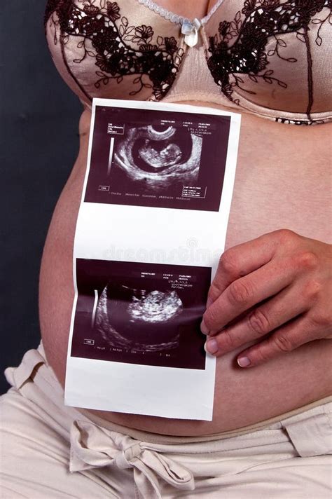 Ultrasound during Pregnancy Stock Photo - Image of pregnancy, feminine ...