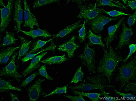 NOTCH2 NOTCH2NL Antibody 68212 1 PBS Proteintech