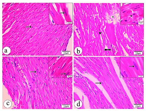 Photomicrographs Of Heart Sections Stained By Hematoxylin And Eosin