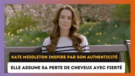 Kate Middleton Refuse La Dissimulation Elle Assume Sa Perte De