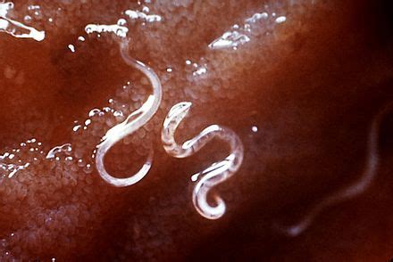 Hookworm vaccine - Wikipedia