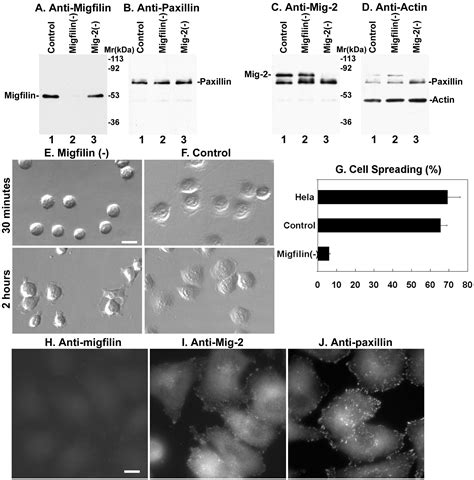 Migfilin And Mig 2 Link Focal Adhesions To Filamin And The Actin