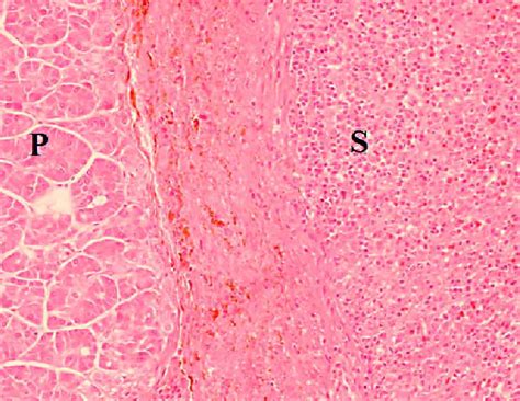 Histologic Staining Confirming An Intrapancreatic Spleen S Surrounded