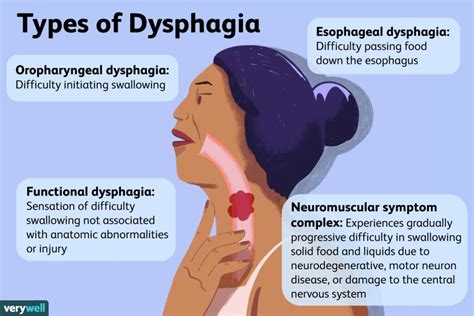 Understanding Dysphagia Causes Symptoms And Treatment Ask The Nurse Expert