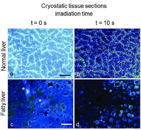 Normal Ab And Fatty Cd Liver From Rat Models Autofluorescence