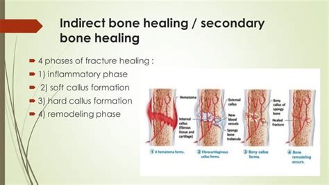 Stages of Bone healing and madalities to enhance bone healing