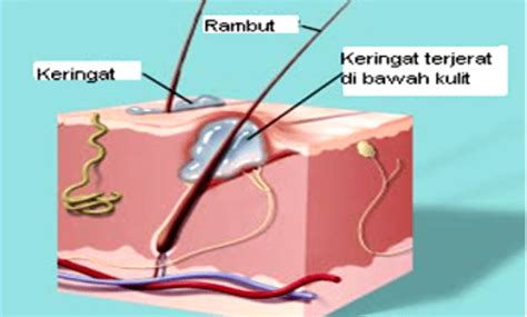 Mekanisme Pengeluaran Keringat Meteor