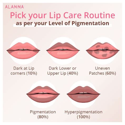 Lip Pigmentation Degree In 2023 Lip Hyperpigmentation Lip Care