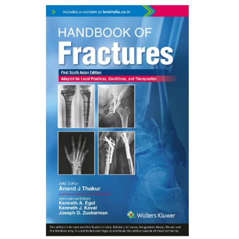 Handbook Of Fractures 1st South Asia Edition 2022 By Anand J Thakur