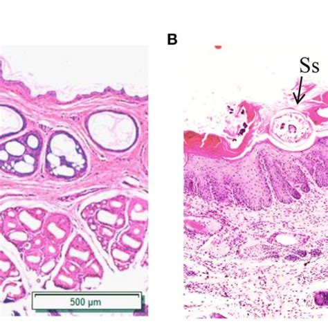 Figure Hematoxylin And Eosin Hande Staining Of Rabbit Skin A