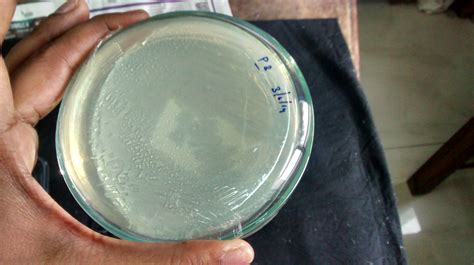 How long should it take for the plaque formation to be seen on the plate?