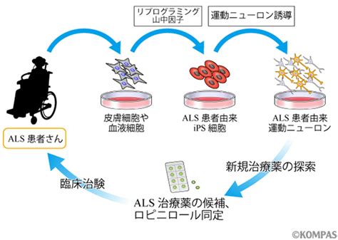 筋萎縮性側索硬化症alsの根本治療を目指して～運動ニューロン疾患外来開設～｜kompas