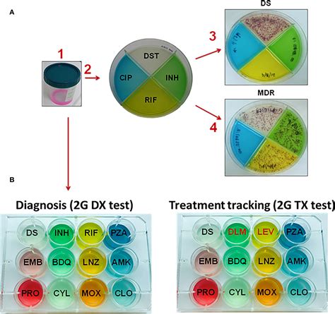 Mycobacterium Tuberculosis Culture