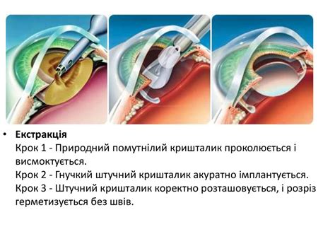 Медсестринський процес при психоневрологічних захворюваннях в похилому ...