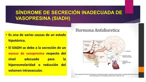 ENFERMEDADES DEL HIPOTALAMO Y LA HIPOFISIS Pptx