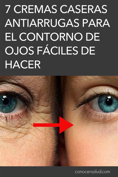 7 Cremas Caseras Antiarrugas Para El Contorno De Ojos Fáciles De Hacer