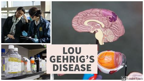 What Is Lou Gehrigs Disease Youtube