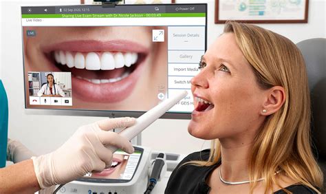 Intraoral dental camera HD - Visionflex