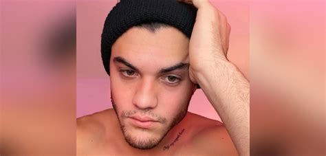 Famoso youtuber Ethan Dolan confesó su cruda experiencia con el acné