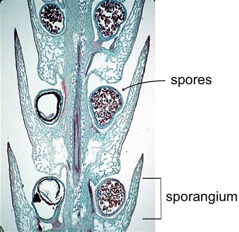 Moss Spores Microscope