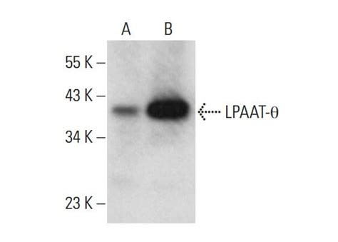 Anti Lpaat Antibody F Scbt Santa Cruz Biotechnology