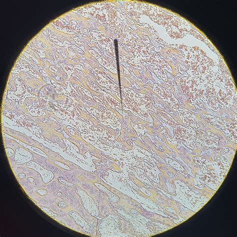 anatomy lab  developing bone  diagram quizlet